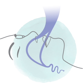 Comprendre le ronflement