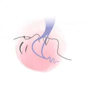 Ronflement ronchopathie causes sommeil arrêter ronfler stop Problème de ronflement bruit fort dormir